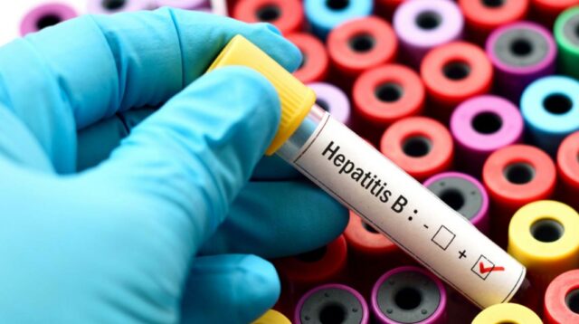 Ini Gejala Hepatitis Akut Misterius pada Anak, Cara Pencegahan, dan Penanganan