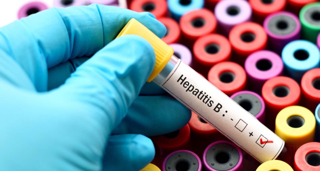 Gejala Hepatitis Akut Misterius pada Anak, Cara Pencegahan, dan Penanganan